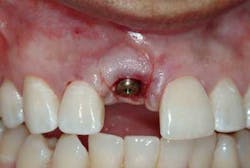 1212adamoantimp07 1212adamoantimp07