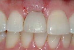 1212adamoantimp09 1212adamoantimp09