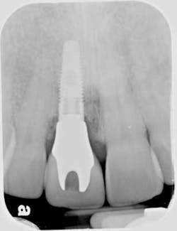 1212adamoantimp10 1212adamoantimp10