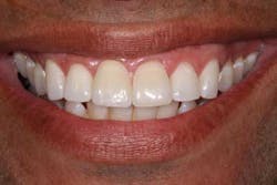 1212adamoantimp11 1212adamoantimp11