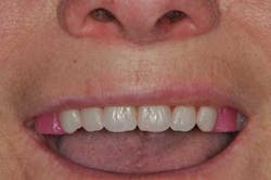 1309srrgardonmollard10a 1309srrgardonmollard10a