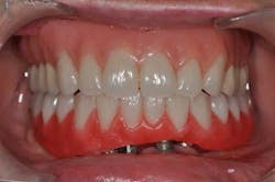 1309srrgardonmollard10b 1309srrgardonmollard10b