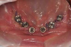 1309srrgardonmollard11 1309srrgardonmollard11