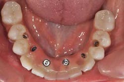 1309srrgardonmollard15a 1309srrgardonmollard15a