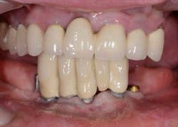 1309srrgardonmollard1b 1309srrgardonmollard1b