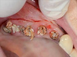 1309srrgardonmollard2 1309srrgardonmollard2