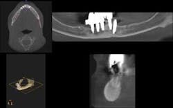 1309srrgardonmollard3 1309srrgardonmollard3