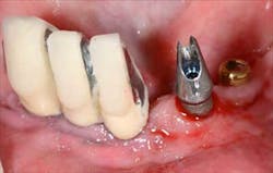 1309srrgardonmollard4a 1309srrgardonmollard4a