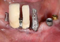 1309srrgardonmollard4b 1309srrgardonmollard4b