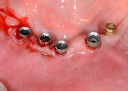 1309srrgardonmollard4c 1309srrgardonmollard4c