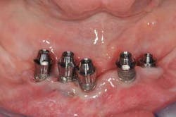 1309srrgardonmollard6a 1309srrgardonmollard6a