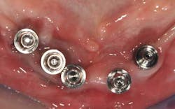 1309srrgardonmollard6b 1309srrgardonmollard6b