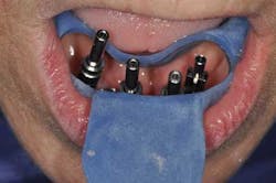 1309srrgardonmollard8 1309srrgardonmollard8