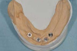 1309srrgardonmollard9a 1309srrgardonmollard9a