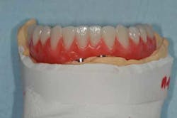 1309srrgardonmollard9c 1309srrgardonmollard9c