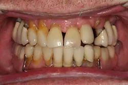 13nov7srrsimmonsao4 1 13nov7srrsimmonsao4 1