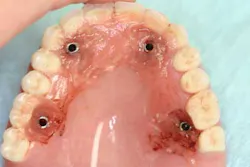 13nov7srrsimmonsao4 10 13nov7srrsimmonsao4 10