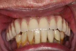 13nov7srrsimmonsao4 11 13nov7srrsimmonsao4 11