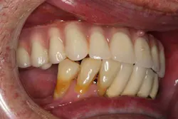 13nov7srrsimmonsao4 12 13nov7srrsimmonsao4 12