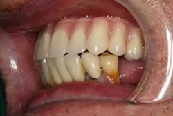 13nov7srrsimmonsao4 13 13nov7srrsimmonsao4 13