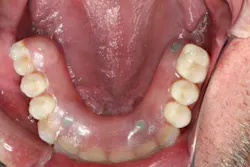 13nov7srrsimmonsao4 15 13nov7srrsimmonsao4 15