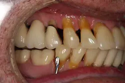 13nov7srrsimmonsao4 2 13nov7srrsimmonsao4 2