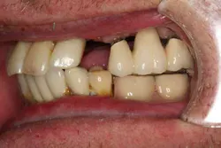 13nov7srrsimmonsao4 3 13nov7srrsimmonsao4 3