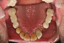 13nov7srrsimmonsao4 4 13nov7srrsimmonsao4 4