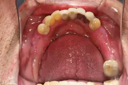 13nov7srrsimmonsao4 5 13nov7srrsimmonsao4 5