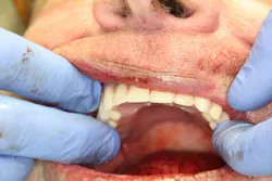 13nov7srrsimmonsao4 6 13nov7srrsimmonsao4 6