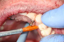 13nov7srrsimmonsao4 8 13nov7srrsimmonsao4 8