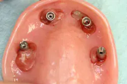 13nov7srrsimmonsao4 9 13nov7srrsimmonsao4 9