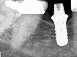 13oct10srrfordtorqued 13oct10srrfordtorqued