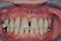 14apr10srrgardonmollardharmony03b 14apr10srrgardonmollardharmony03b