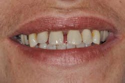 14apr10srrgardonmollardharmony03c 14apr10srrgardonmollardharmony03c