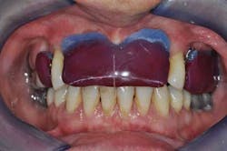 14apr10srrgardonmollardharmony06a 14apr10srrgardonmollardharmony06a