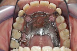 14apr10srrgardonmollardharmony08a 14apr10srrgardonmollardharmony08a