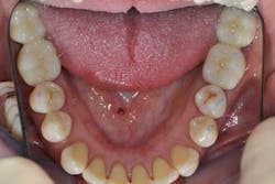 14apr10srrgardonmollardharmony08b 14apr10srrgardonmollardharmony08b