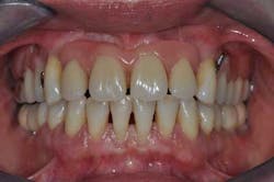 14apr10srrgardonmollardharmony08c 14apr10srrgardonmollardharmony08c