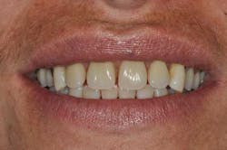 14apr10srrgardonmollardharmony08d 14apr10srrgardonmollardharmony08d