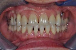 14apr10srrgardonmollardharmony09a 14apr10srrgardonmollardharmony09a