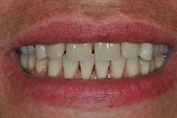 14apr10srrgardonmollardharmony09b 14apr10srrgardonmollardharmony09b