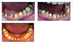 14apr24srrshine06 14apr24srrshine06