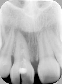 14feb27srrdibernardotoskosfig1a 14feb27srrdibernardotoskosfig1a