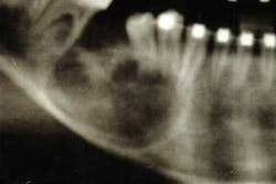 14feb27srrramerhpt Jt05 14feb27srrramerhpt Jt05