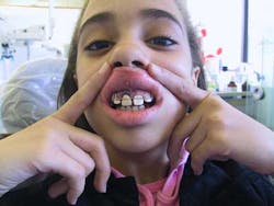 14feb28srrdibernardotoskosfig2c 14feb28srrdibernardotoskosfig2c