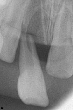 14febsrrsimmonsdentaltrauma01 14febsrrsimmonsdentaltrauma01