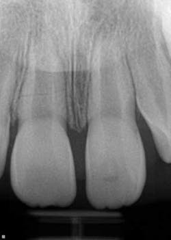 14febsrrsimmonsdentaltrauma02 14febsrrsimmonsdentaltrauma02