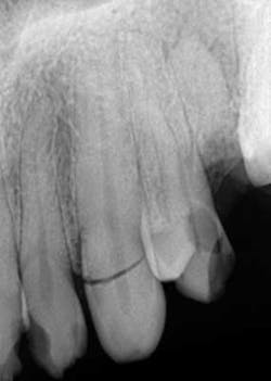 14febsrrsimmonsdentaltrauma03 14febsrrsimmonsdentaltrauma03