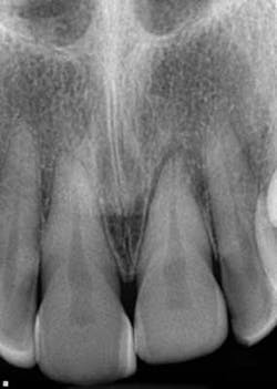 14febsrrsimmonsdentaltrauma04 14febsrrsimmonsdentaltrauma04